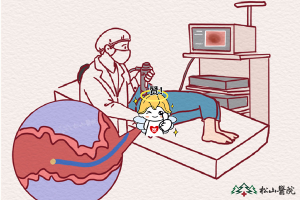 腸鏡檢查。重慶松山醫院供圖