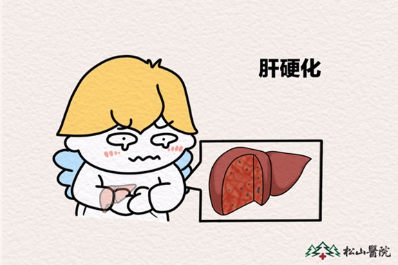 肝硬化。重慶松山醫院供圖