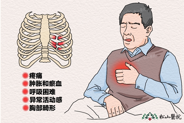 肋骨骨折癥狀。重慶松山醫院供圖