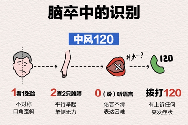 “中風120”口訣。重慶松山醫院供圖