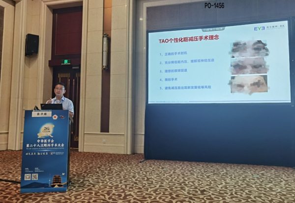袁洪峰上臺分享。重慶愛爾眼科醫院總院供圖