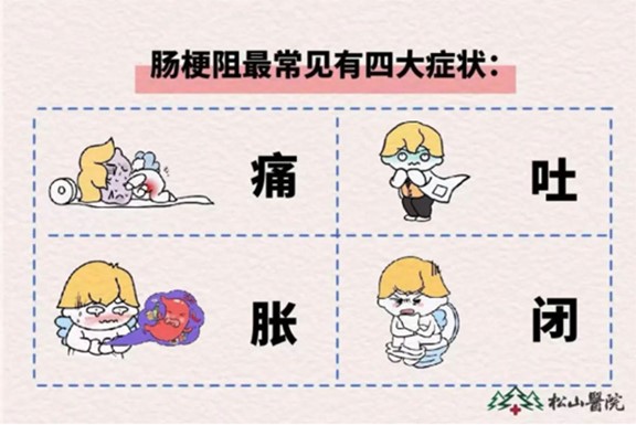 腸梗阻癥狀。重慶松山醫院供圖