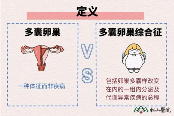 多囊與多囊卵巢綜合征的定義。重慶松山醫院供圖