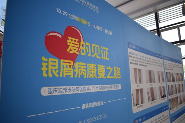 活動現場。重慶迪邦皮膚病醫院供圖