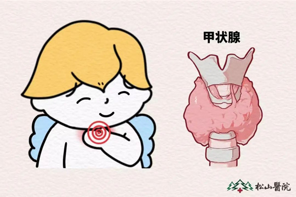 示意圖。重慶松山醫院供圖