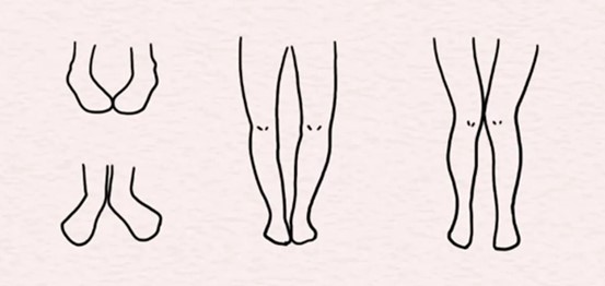 示意圖。重慶松山醫院供圖