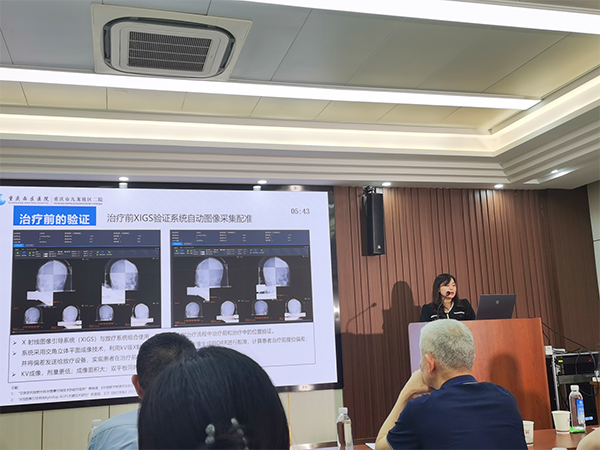 周小琴分享案例：《SupeRay無創治療在大體積延髓腫瘤中的位置驗證》。重慶西區醫院供圖